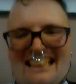 ADFbutterteeth.PNG