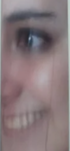 eye.PNG
