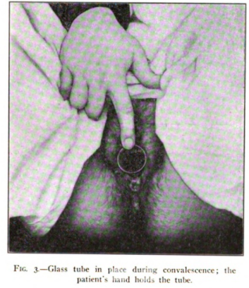 fig3.png