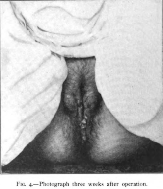 fig4.png