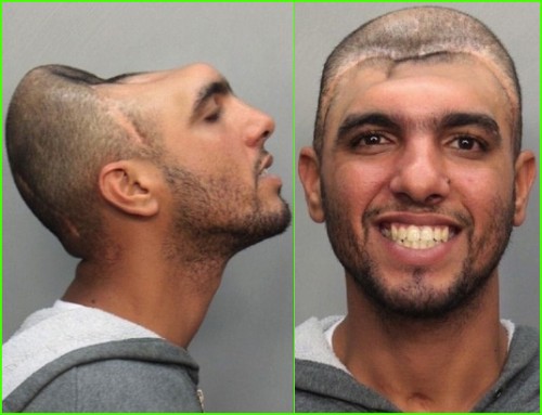 flat-head-2.jpg