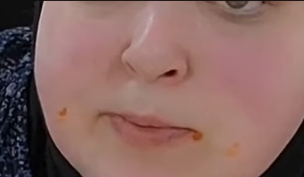 ick1.jpg