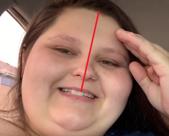 middletooth.jpg