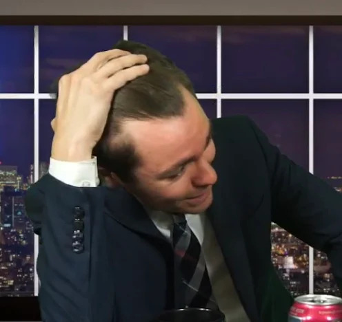 vegeta-hairline.jpeg